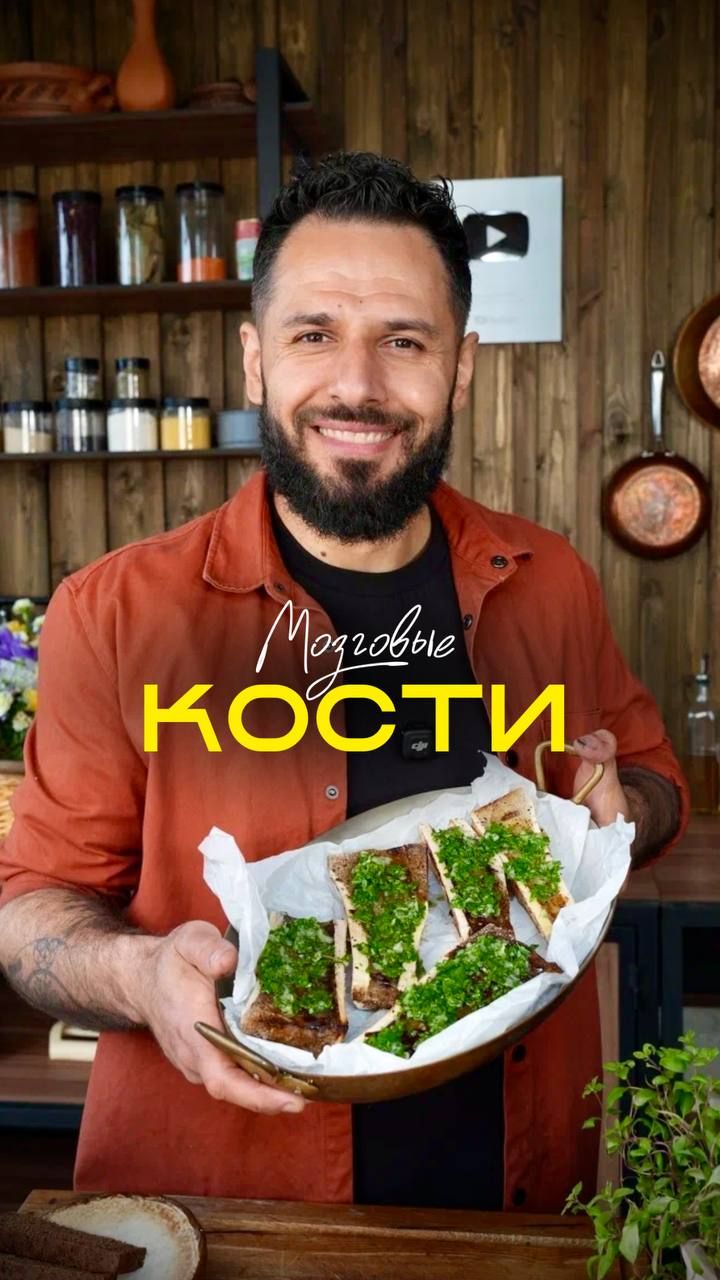 Мозговые кости