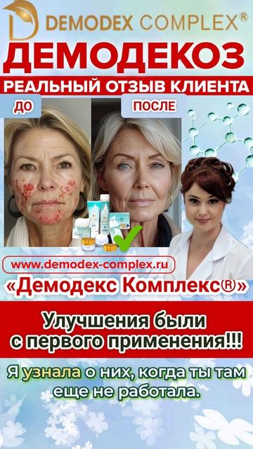 ДЕМОДЕКОЗ. Отзыв_🔟 лет верности_ История клиентки, которая нашла свою идеальную косметику. #демодек