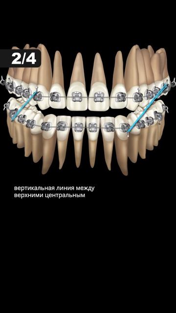Как проверить правильность прикуса самостоятельно