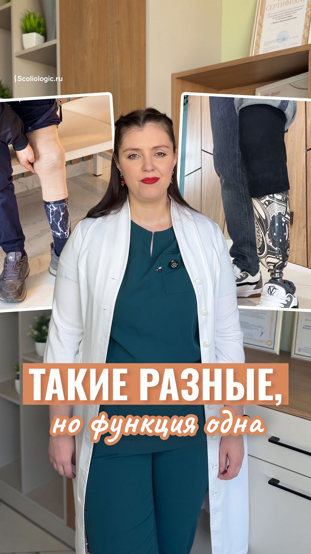 Что важнее для протеза голени – дорогой силикон или простая привычка?