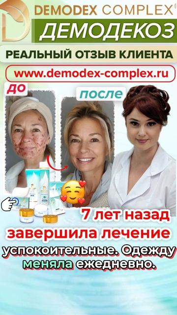 ДЕМОДЕКОЗ. Отзыв_ 7 ЛЕТ БЕЗ РЕЦИДИВОВ! Клиентка делится историей успешного лечения. #демодекс