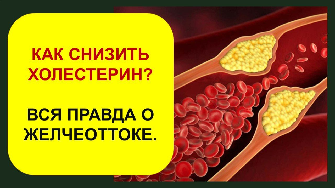 Как быстро снизить холестерин?