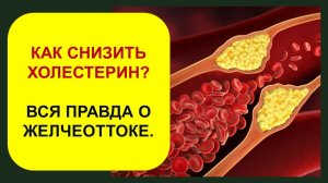 Как быстро снизить холестерин?