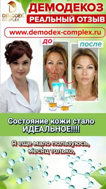🌟«ДЕМОДЕКС КОМПЛЕКС®» – ЧЕСТНЫЙ ОТЗЫВ КЛИЕНТКИ_ РЕЗУЛЬТАТ ЗА 3 НЕДЕЛИ!💚  #демодекс #демодекслечени