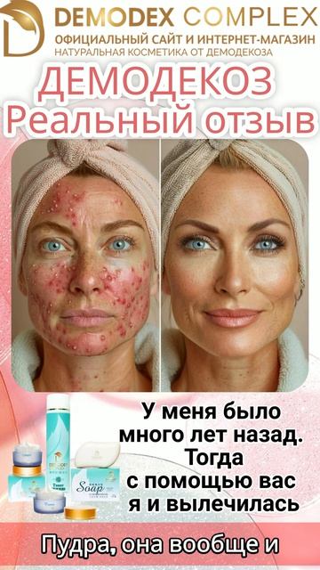 ДЕМОДЕКОЗ 💫 Как я победила демодекоз_ реальная история клиентки Demodex Complex #демодекс #демодеко