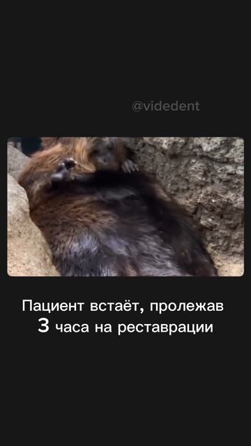 Пациент после долгой реставрации зуба | стоматологический юмор 😂
