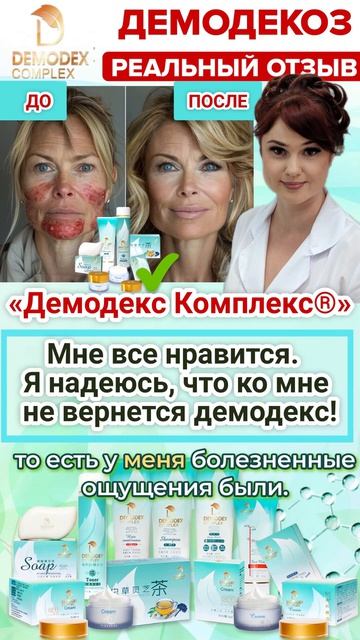 🌟 РОЗАЦЕА И ДЕМОДЕКС ПОБЕЖДЕНЫ! Честный отзыв после месяца использования. #демодекс #демодекоз