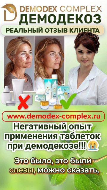 🔥 ШОКИРУЮЩИЙ ОТЗЫВ! Как _Демодекс Комплекс_ спас лицо после ПРОВАЛА больничного лечения! 😱