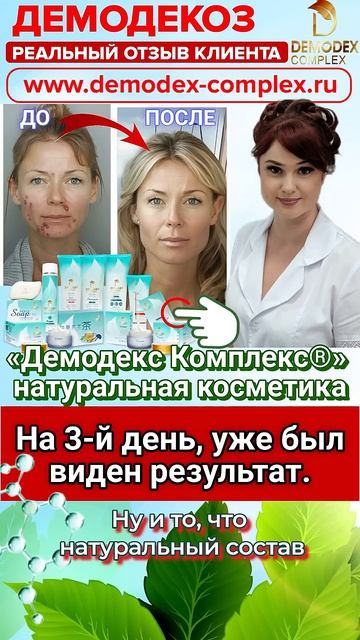 ДЕМОДЕКОЗ. Отзыв_ 🚀 РЕЗУЛЬТАТ НА 3-Й ДЕНЬ! Высыпаний уже нет после 2 месяцев использования #демодек