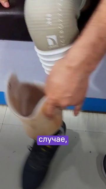 Стоит ли бинтовать культю, если вы уже носите протез и лайнер?