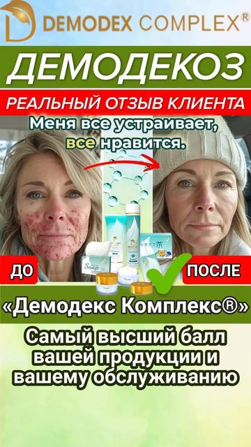 💎 Почему «Демодекс Комплекс®» - выбор тех, кто ценит качество_ Реальный отзыв клиента
