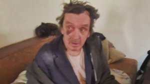 КТО НАБИЛ СИНЯК ВОЛОДИ 😱а на кого ты прикажешь показать ..........