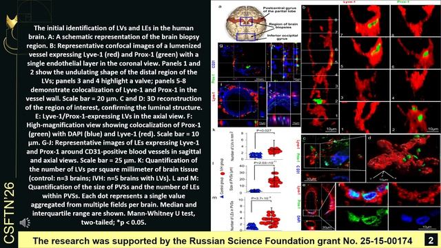 Immunofluorescence identification of the Lyve-1Prox-1 expressing lymphatic elements i смотреть онлайн