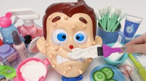 Игрушка для выдавливания прыщей и ухода за кожей лица! Распаковка, Обзор игрушек! Мультики для детей