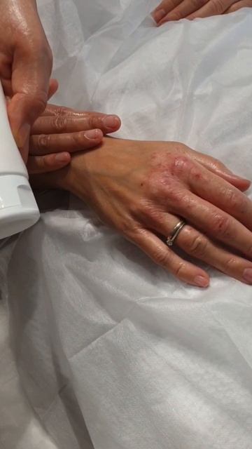 Применение массажного крема LADOLEAY качестве восстанавливающего средства при кожных заболеваниях