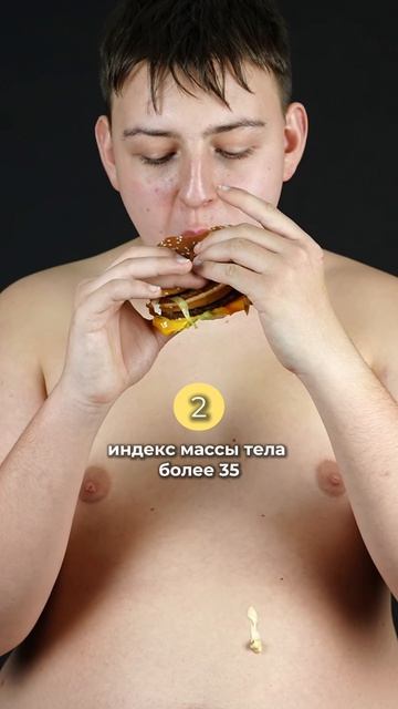 Ожирение. Бариатрическая операция. Юсуповская Больница. Кадыров Ильяс