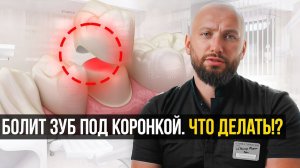 Почему БОЛИТ зуб под КОРОНКОЙ, все ПРИЧИНЫ и методы ЛЕЧЕНИЯ
