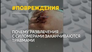 Цена рекорда: барнаульцы все чаще получают переломы после ударов по силомерам
