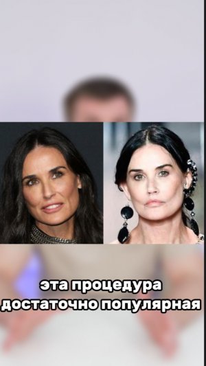 Почему нельзя удалять комки Биша?