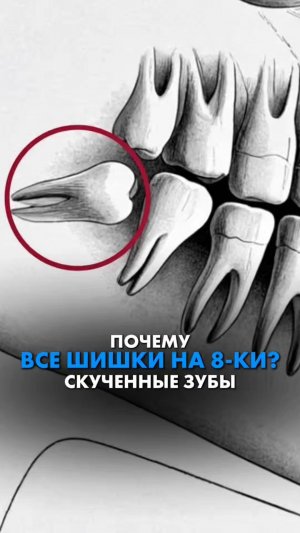 ПОЧЕМУ ВСЕ ШИШКИ НА 8-КИ? СКУЧЕННЫЕ ЗУБЫ