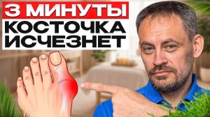 УБЕРИ КОСТОЧКУ на пальце! 2 техники для восстановления стопы