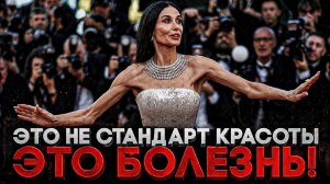 Alex СМОТРИТ: ЭТО НЕ СТАНДАРТ КРАСОТЫ, ЭТО БОЛЕЗНЬ! (СТЕБЛОВ)