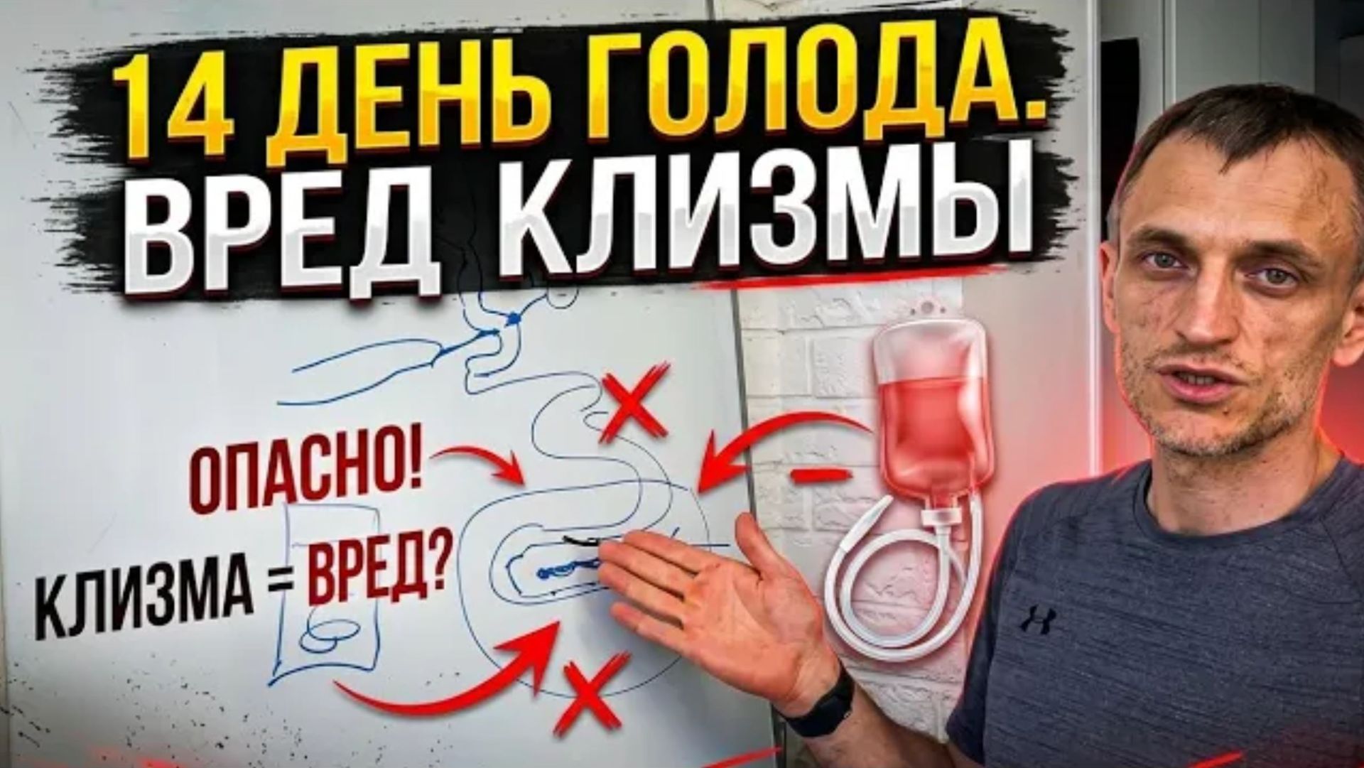 14 день голода. Вред клизмы