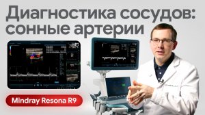 Mindray Resona R9 в работе врача: УЗИ сонных артерий и оценка сосудов