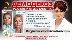 ДЕМОДЕКОЗ_ Демодекс Комплекс - отзыв только положительный! Уже заканчиваю лечение мне очень нравится