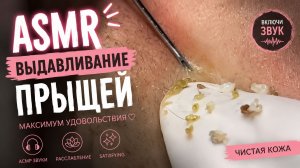 АСМР Выдавливание Прыщей #1
