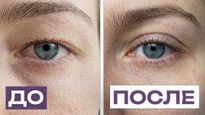 ПОДНИМАЕМ нависшее веко за 2 МИНУТЫ! / Упражнение, которое работает СРАЗУ