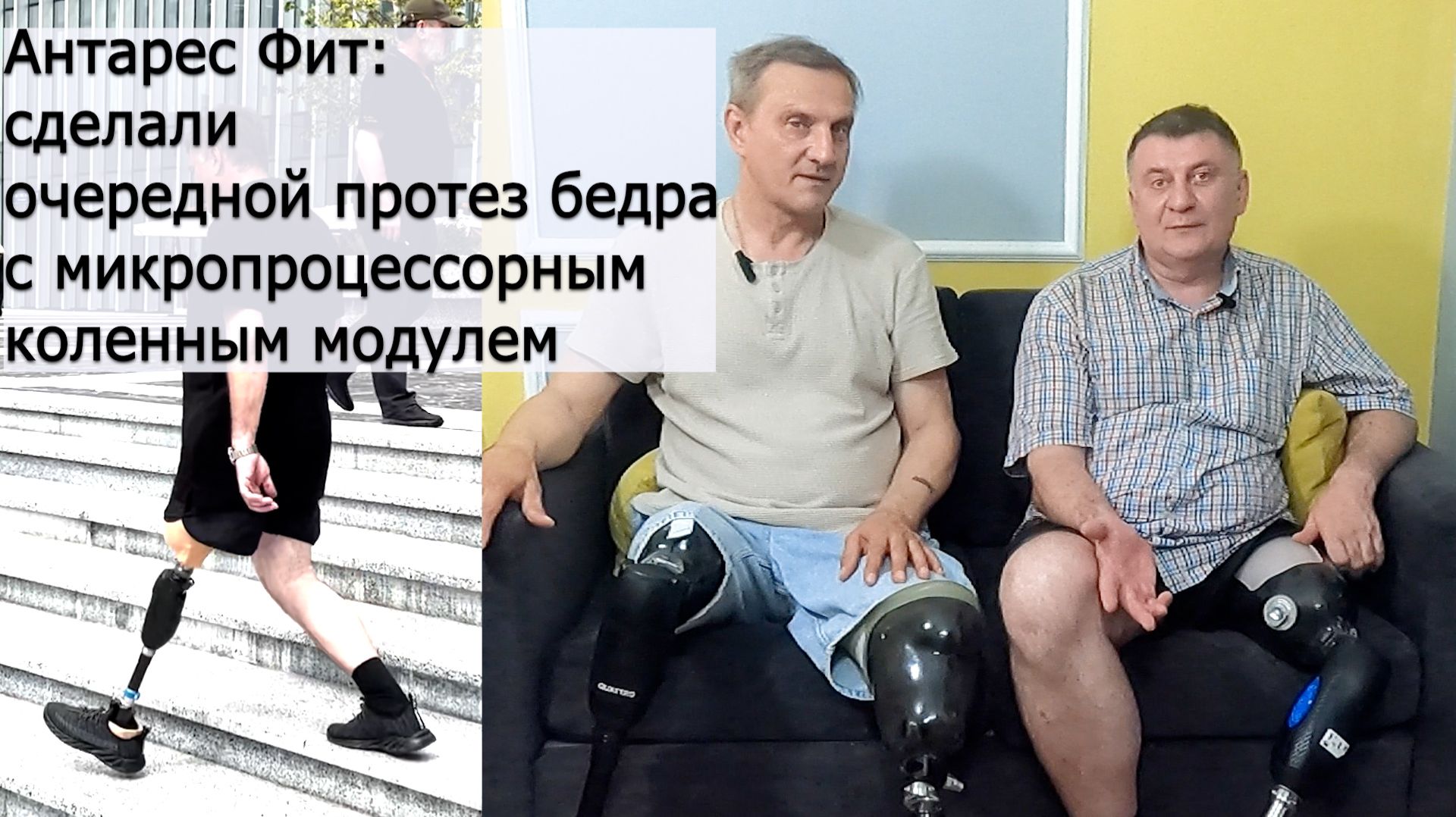 Антарес Фит: сделали очередной протез бедра с микропроцессорным коленным модулем смотреть онлайн