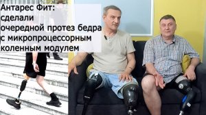 Антарес Фит:  сделали очередной протез бедра с микропроцессорным коленным модулем
