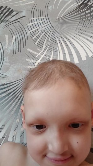 сбор на протезирование зубов