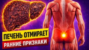 10 ранних Признаков того, что ваша ПЕЧЕНЬ ОТМИРАЕТ. 90% с проблемами печени даже не знают об этом