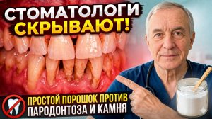 СТОМАТОЛОГИ СКРЫВАЮТ, простой ПОРОШОК против пародонтоза и зубного камня