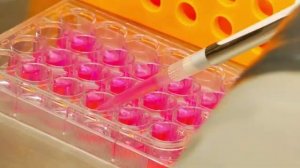 TTS - Episode 1_ Thyroid Disease Revealed.mp4