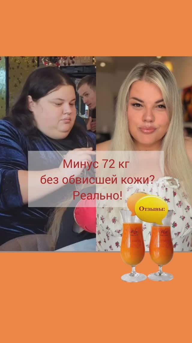 Минус 72 кг без обвисшей кожи? Реально!