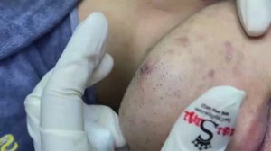153 • Acne collection • АСМР • Relax Spa