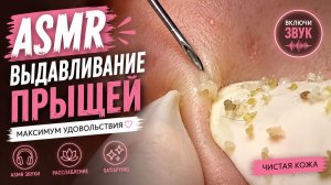 АСМР Выдавливание Прыщей #3