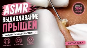 АСМР Выдавливание Прыщей #4