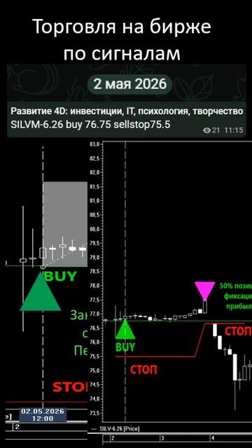 Silver 02.05.26 +7%