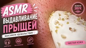 АСМР Выдавливание Прыщей #2