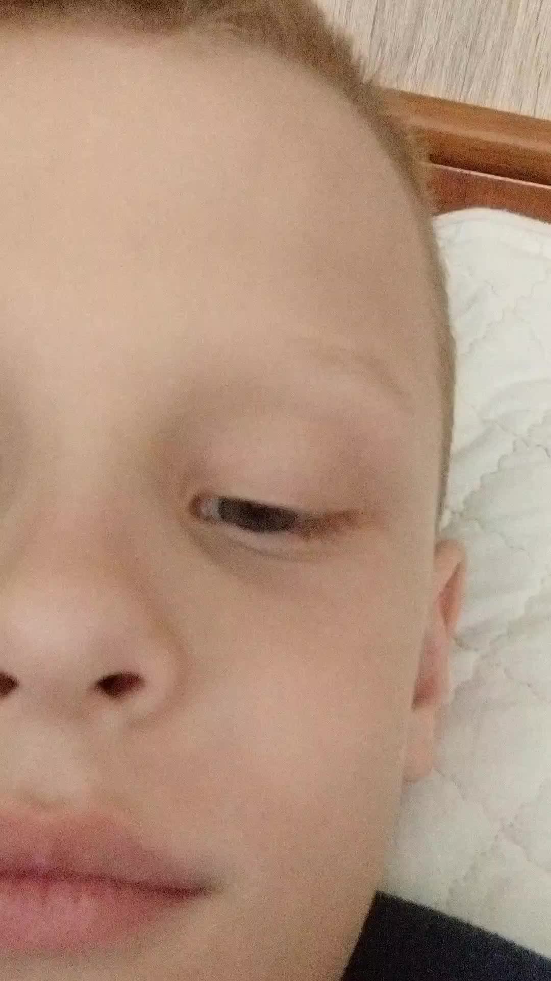 67