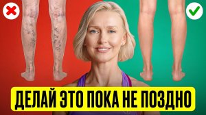 СУДОРОГИ И ОТЁКИ В НОГАХ — уйдут после ЭТИХ упражнений за 10 минут