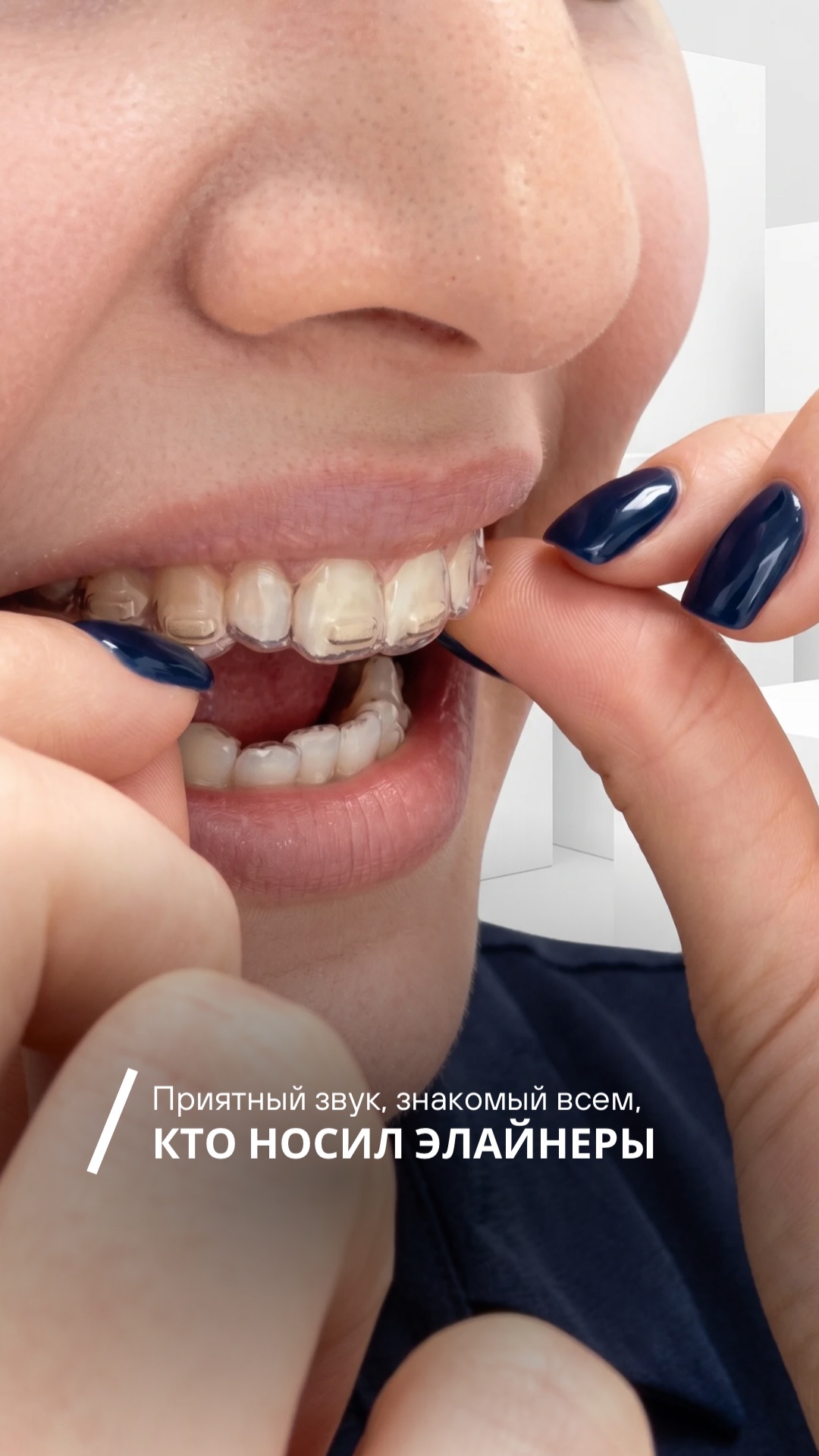 Приятный звук, знакомый всем, кто носит или носил элайнеры🎧