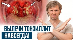 ЗАБУДЬТЕ про больное горло НАВСЕГДА! / Копеечные средства и упражнения от тонзиллита!