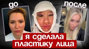 Эндоскопия лба и блефаропластика в 39 лет, моя история