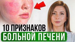 10 признаков, что ПЕЧЕНЬ БОЛЬНА! Как проверить здоровье печени?
