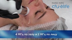 CFU-Èlife - первый бескартриджный аппарат для SMAS-лифтинга от компании Biotec